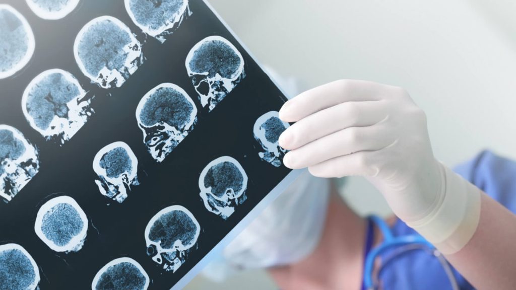neurocirugia_op2